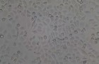 OP9细胞|OP9小鼠骨髓基质细胞